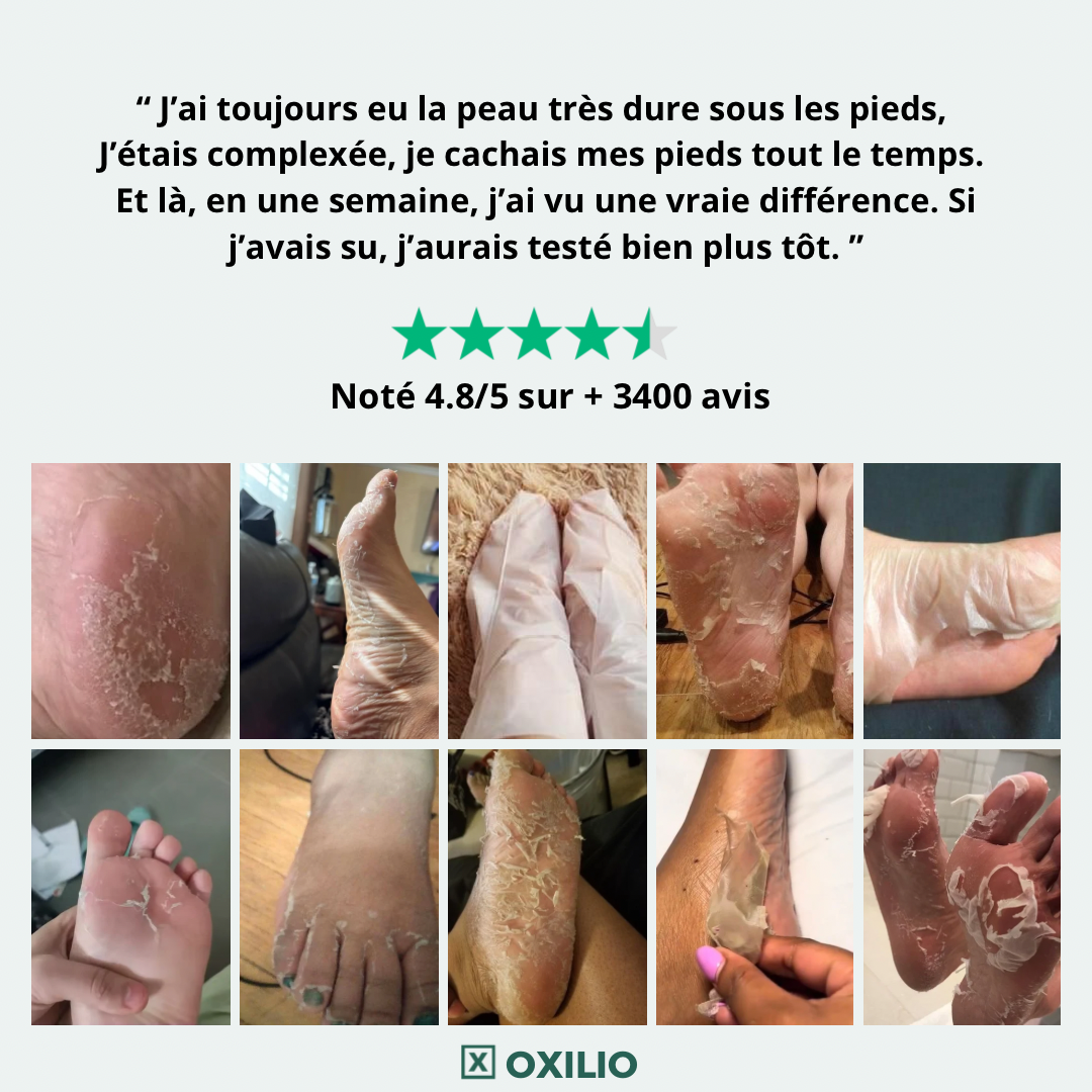 Masque Peeling pied - OXELIO