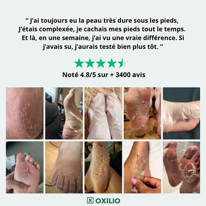 Masque Peeling pied - OXELIO