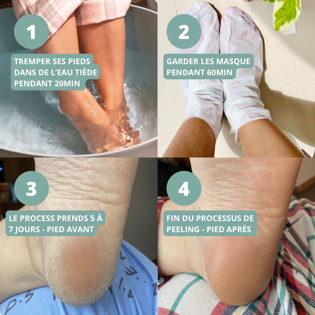 Masque Peeling pied - OXELIO